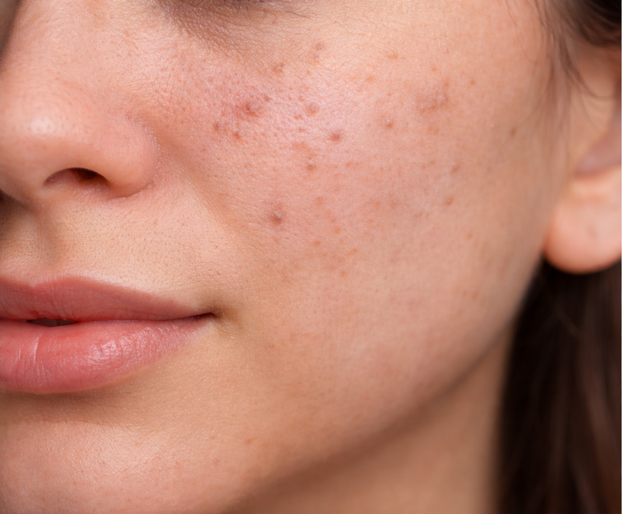 Dark Spots & Glow