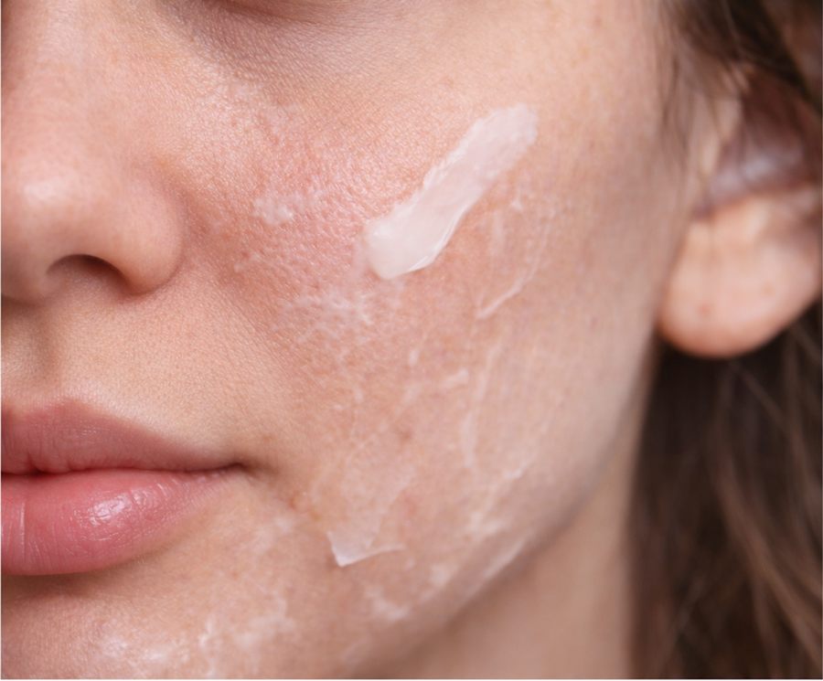 Dryness & Barrier Repair